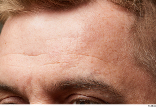 HD Face Skin Steve Q eyebrow face forehead scar skin…